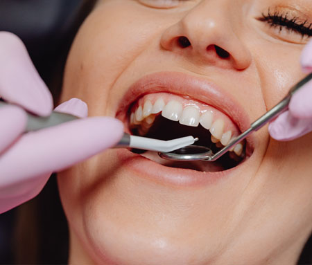 牙齒修複使用烤瓷牙與全瓷牙有什麽區别？